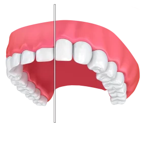 Dental Anatomy Illustration: Precise Tooth Alignment Clipart Visualization