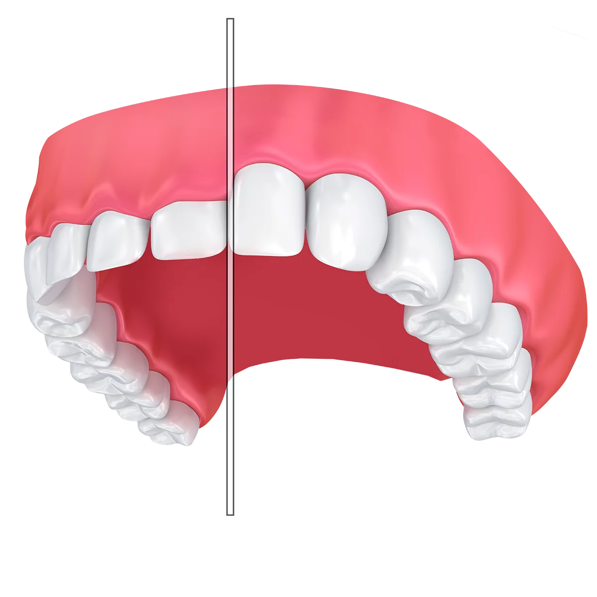 Dental Anatomy Illustration: Precise Tooth Alignment Clipart Visualization