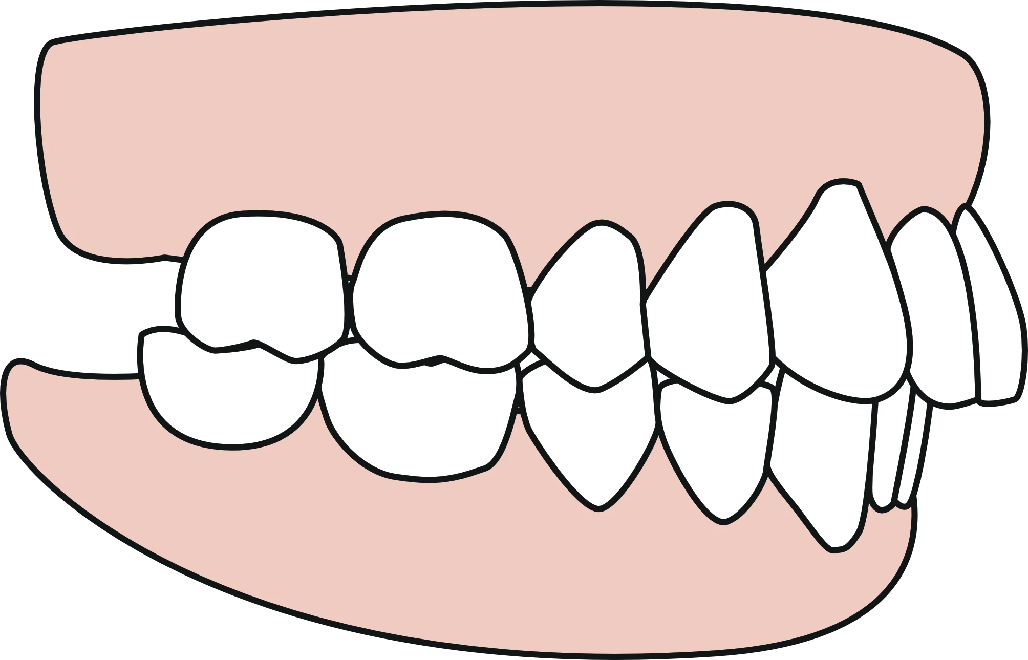 Medical Illustration of Dental Alignment Showing Tooth Positioning Clipart