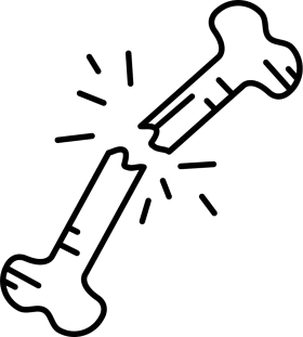 Simplified Bone Fracture Illustration Clipart - Medical Graphic Design Element