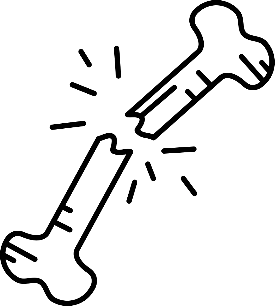 Simplified Bone Fracture Illustration Clipart - Medical Graphic Design Element