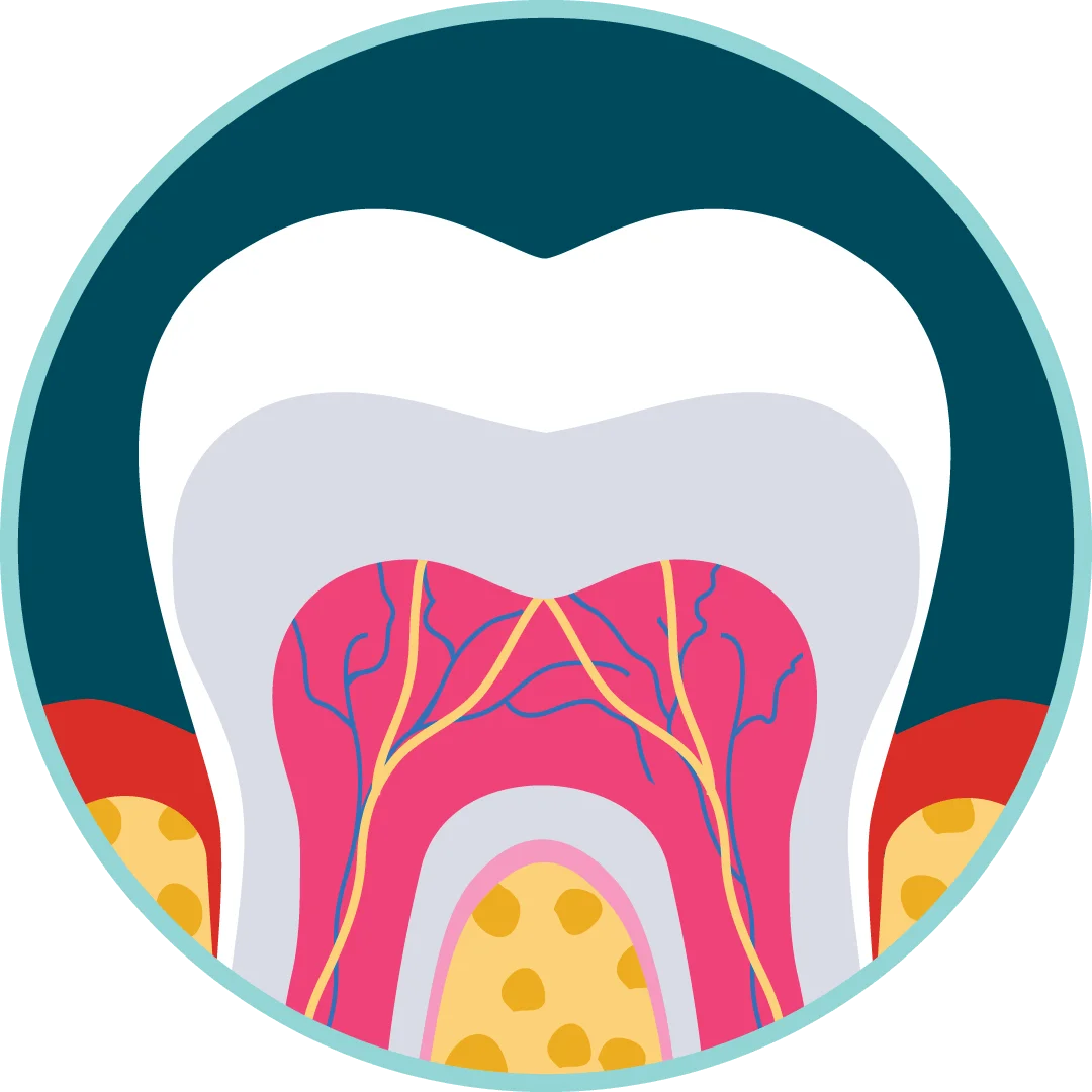 Detailed Cross-Section Dental Anatomy Clipart: Revealing Inner Tooth Structure