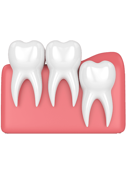 Exposing impacted teeth post op oral surgeon in marietta ga clipart vector