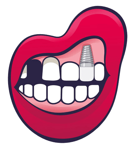 Teeth extractions ridge preservation enviable gums sea girt nj clipart background