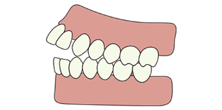 Teeth mon problems kingry orthodontics clipart transparent