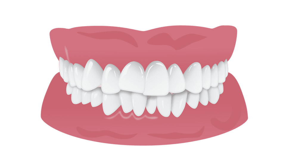 Teeth openbite clear aligner experts pune clipart picture