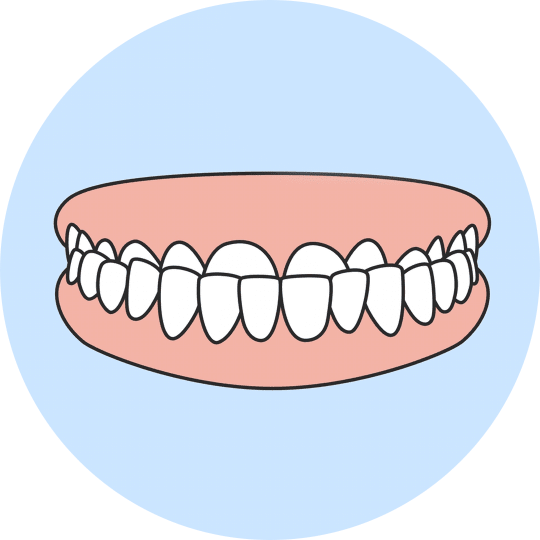 Teeth transform your smile effective solutions for underbite clipart transparent